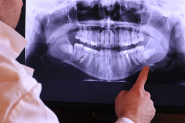 Best Emergency Dentist for Knocked-Out Tooth in Carnation, WA